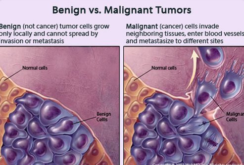 What Causes A Cell To Become Cancerous